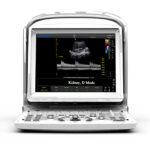 Ultrasound B&W Chison ECO 3 Expert + doppler - screen