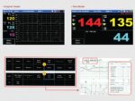 GIMA FC1400 TWINS εμβρυική οθόνη