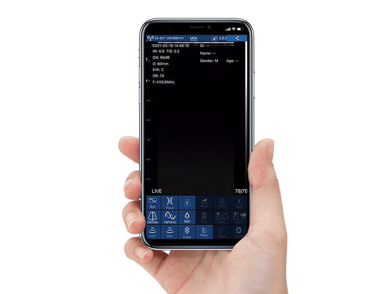 C10t Wireless 3 in 1 portable ultrasound app