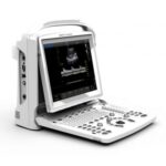 Ultrasound B&W Chison ECO 3 Expert + doppler