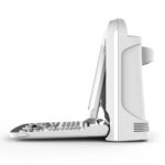 Ultrasound B&W Chison ECO 3 Expert + doppler - side view