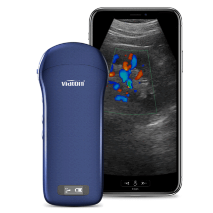Viatom 3-in-1 portable ultrasound - C10t