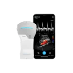 Portable ultrasound VSCAN AIR SL